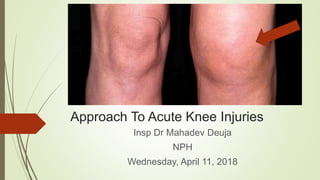 Approach To Acute Knee Injuries
Insp Dr Mahadev Deuja
NPH
Wednesday, April 11, 2018
 