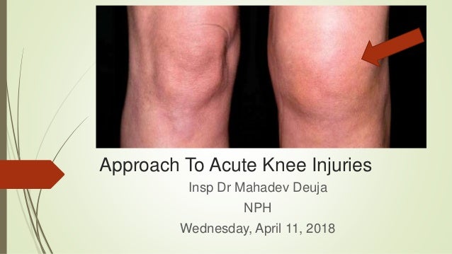Approach To Acute Knee Injuries Knee Injury