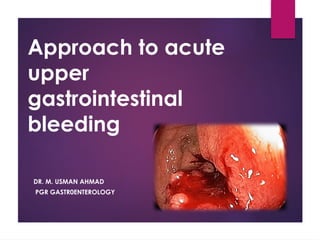 Approach to acute upper gastrointestinal bleeding(1) (1)-5(3).pptx