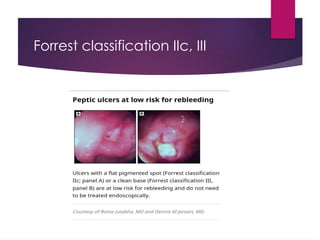 Approach to acute upper gastrointestinal bleeding(1) (1)-5(3).pptx