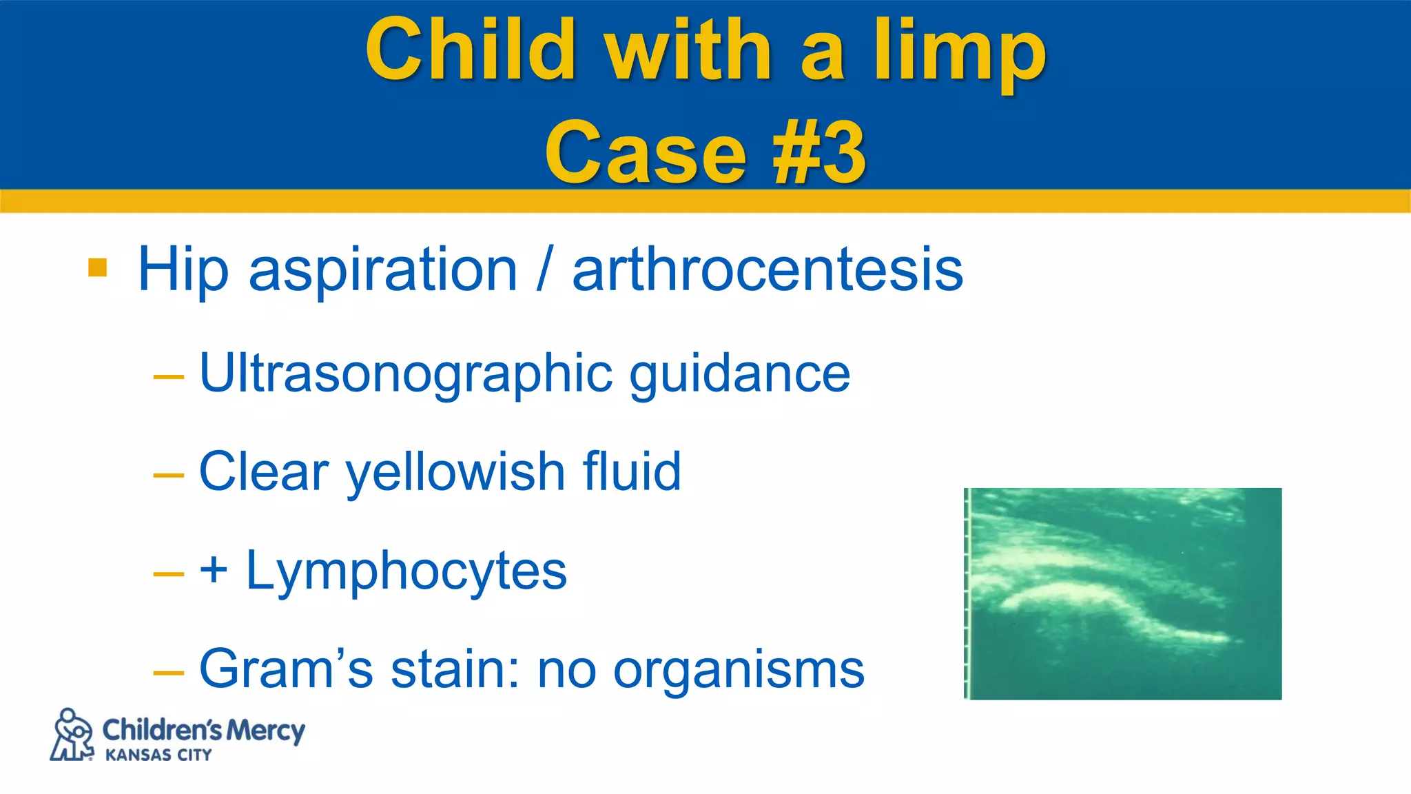 Child with a limp
Case #3
 Hip aspiration / arthrocentesis
– Ultrasonographic guidance
– Clear yellowish fluid
– + Lymphocytes
– Gram’s stain: no organisms
 