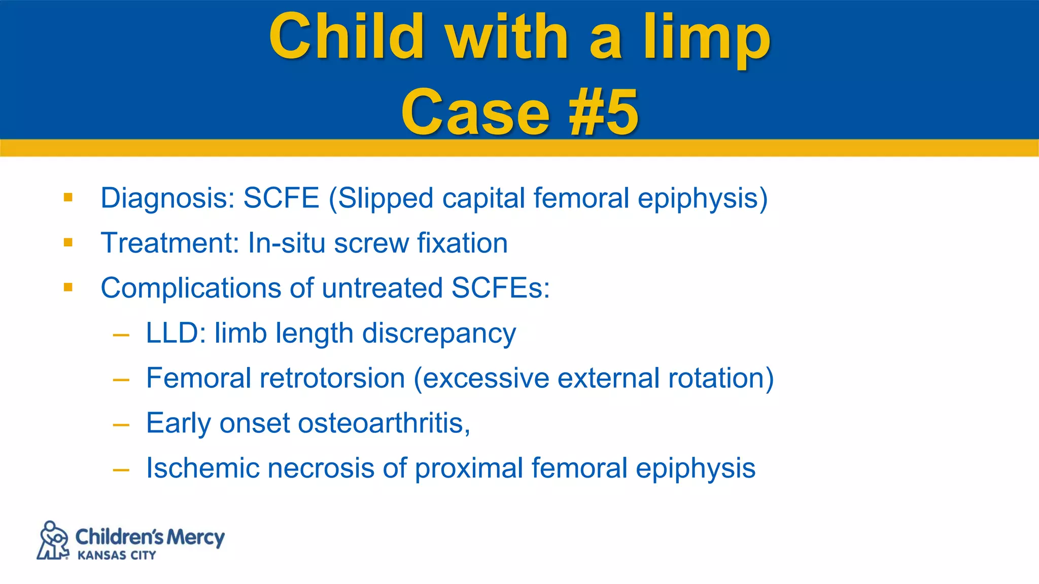 Child with a limp
Case #5
 Diagnosis: SCFE (Slipped capital femoral epiphysis)
 Treatment: In-situ screw fixation
 Complications of untreated SCFEs:
– LLD: limb length discrepancy
– Femoral retrotorsion (excessive external rotation)
– Early onset osteoarthritis,
– Ischemic necrosis of proximal femoral epiphysis
 