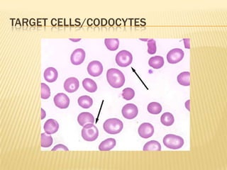 TARGET CELLS/CODOCYTES
 