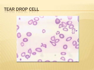 TEAR DROP CELL
 