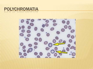 POLYCHROMATIA
 
