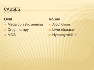 CAUSES
Oval
 Megaloblastic anemia
 Drug therapy
 MDS
Round
 Alcoholism
 Liver disease
 Hypothyroidism
 