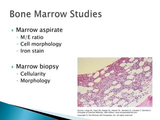    Marrow aspirate
    ◦ M/E ratio
    ◦ Cell morphology
    ◦ Iron stain


   Marrow biopsy
    ◦ Cellularity
    ◦ Morphology
 