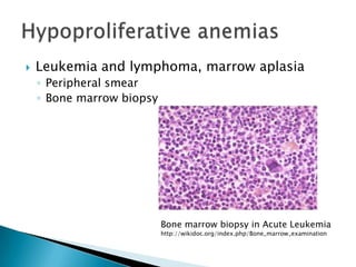    Leukemia and lymphoma, marrow aplasia
    ◦ Peripheral smear
    ◦ Bone marrow biopsy




                           Bone marrow biopsy in Acute Leukemia
                           http://wikidoc.org/index.php/Bone_marrow_examination
 