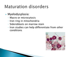    Myelodysplasia:
    ◦   Macro or microcytosis
    ◦   Iron ring in mitochondria
    ◦   Sideroblasts on marrow stain
    ◦   Iron studies can help differentiate from other
        conditions
 