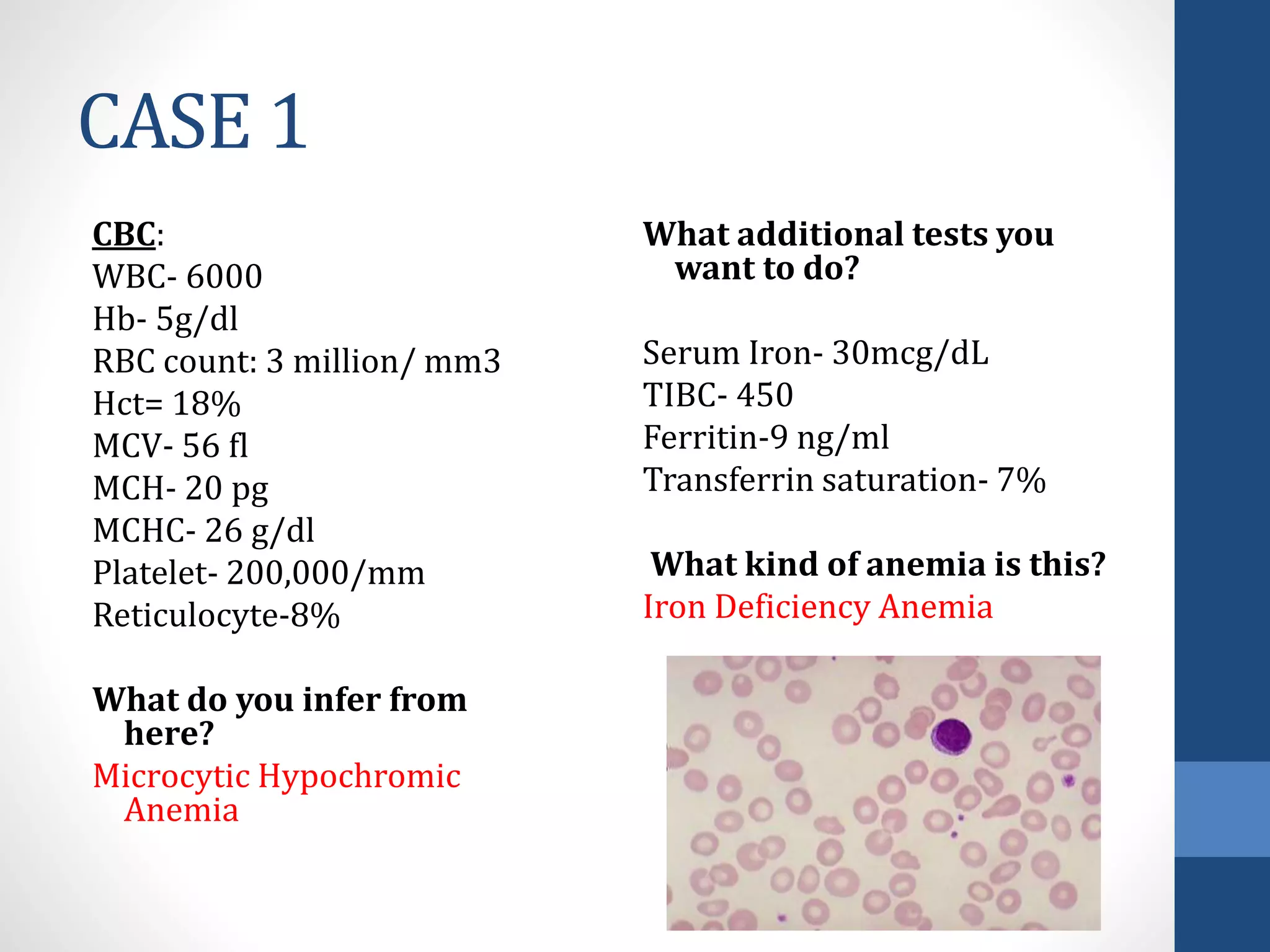 Approach to anemia | PPTX