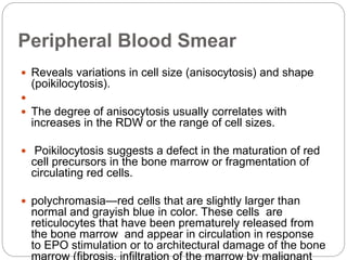 Peripheral Blood Smear
 Reveals variations in cell size (anisocytosis) and shape
(poikilocytosis).

 The degree of anisocytosis usually correlates with
increases in the RDW or the range of cell sizes.
 Poikilocytosis suggests a defect in the maturation of red
cell precursors in the bone marrow or fragmentation of
circulating red cells.
 polychromasia—red cells that are slightly larger than
normal and grayish blue in color. These cells are
reticulocytes that have been prematurely released from
the bone marrow and appear in circulation in response
to EPO stimulation or to architectural damage of the bone
marrow (fibrosis, infiltration of the marrow by malignant
 