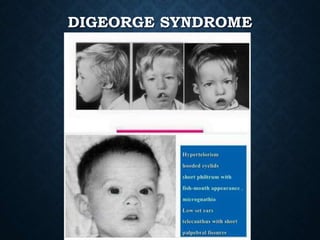 Approach to a newborn with multiple congenital anomaly | PPTX