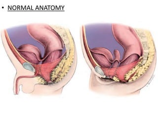 • NORMAL ANATOMY
 
