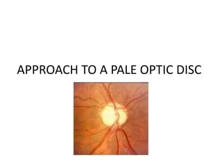 APPROACH TO A PALE OPTIC DISC
 