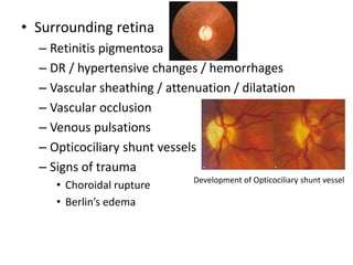 • Surrounding retina
– Retinitis pigmentosa
– DR / hypertensive changes / hemorrhages
– Vascular sheathing / attenuation / dilatation
– Vascular occlusion
– Venous pulsations
– Opticociliary shunt vessels
– Signs of trauma
• Choroidal rupture
• Berlin’s edema
Development of Opticociliary shunt vessel
 
