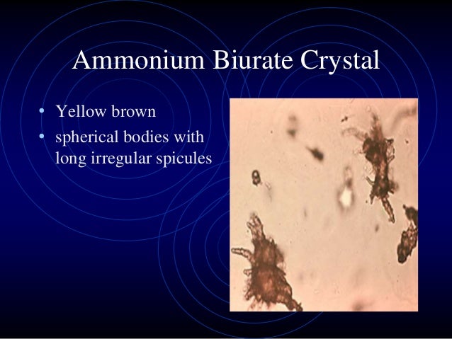 approach to a patient with active urinary sediments 43 638