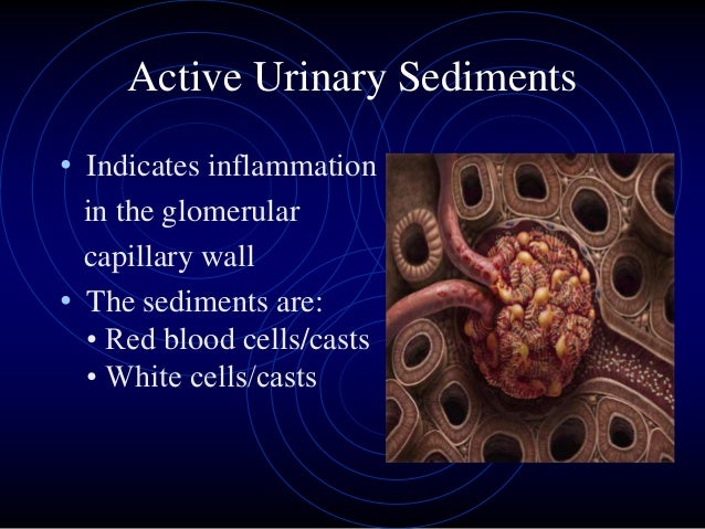 approach to a patient with active urinary sediments 45 638