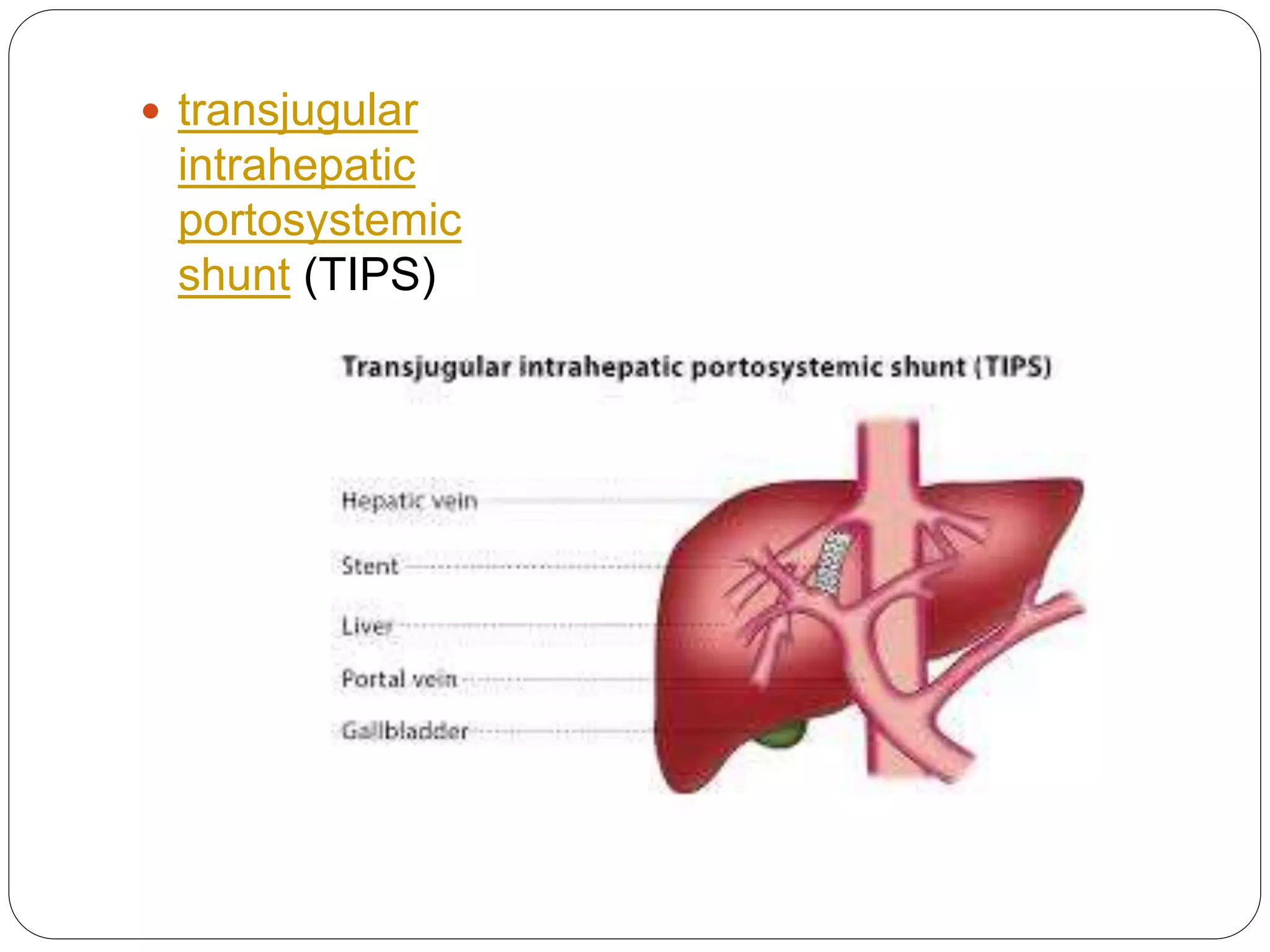  transjugular
intrahepatic
portosystemic
shunt (TIPS)
 