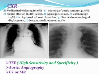 Approach to a patient with chest pain | PPTX