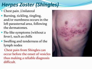 Shingles In Chest Approach to a patient with chest pain | PPTX