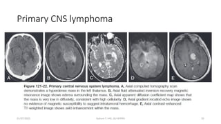 Approach to a patient with CNS tumor.pptx