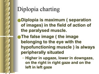 Approach to a patient with Diplopia.pptx