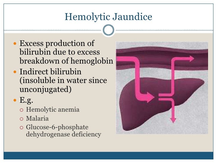 Approach To A Patient With Jaundice