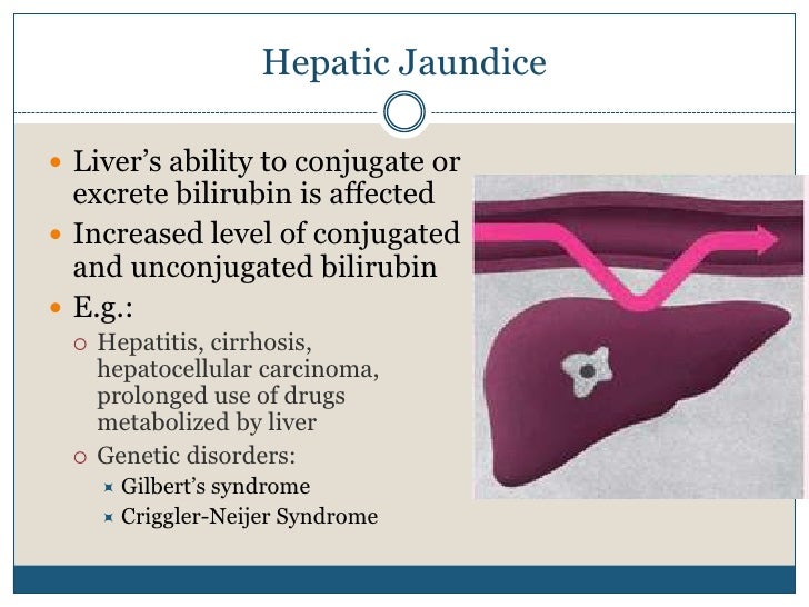 Approach To A Patient With Jaundice