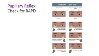 Approach to a patient with penetrating ocular trauma 3.pptx
