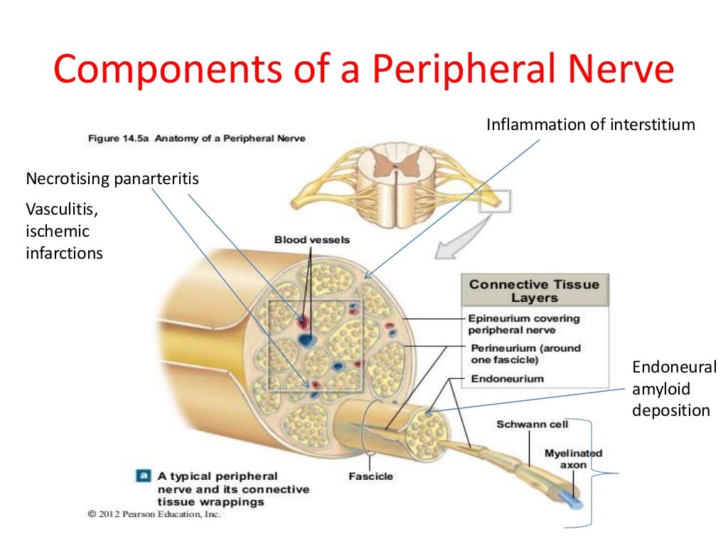 Approach to a patient with peripheral neuropathy