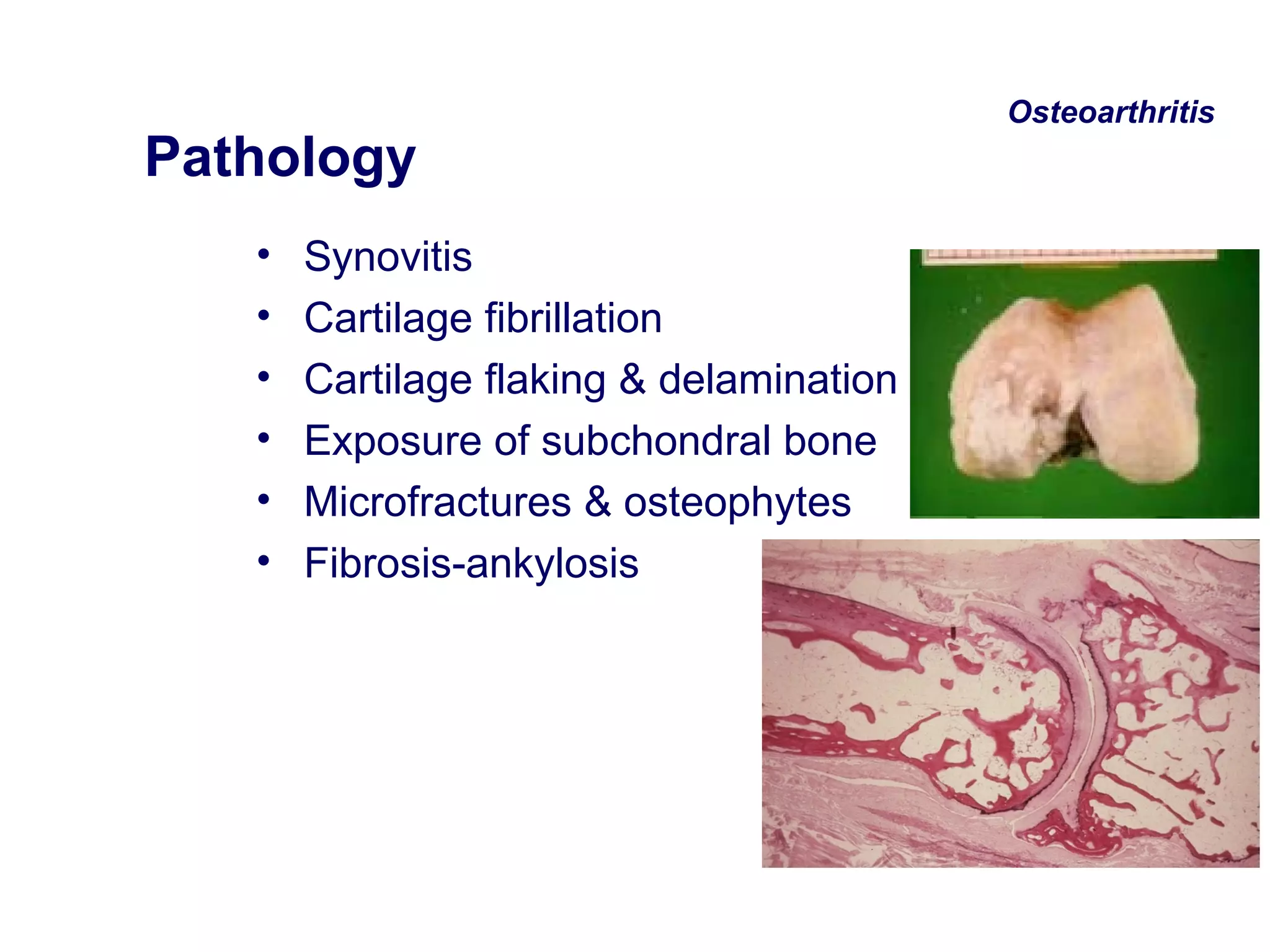 Approach To A Patient With Polyarthritis | PPT