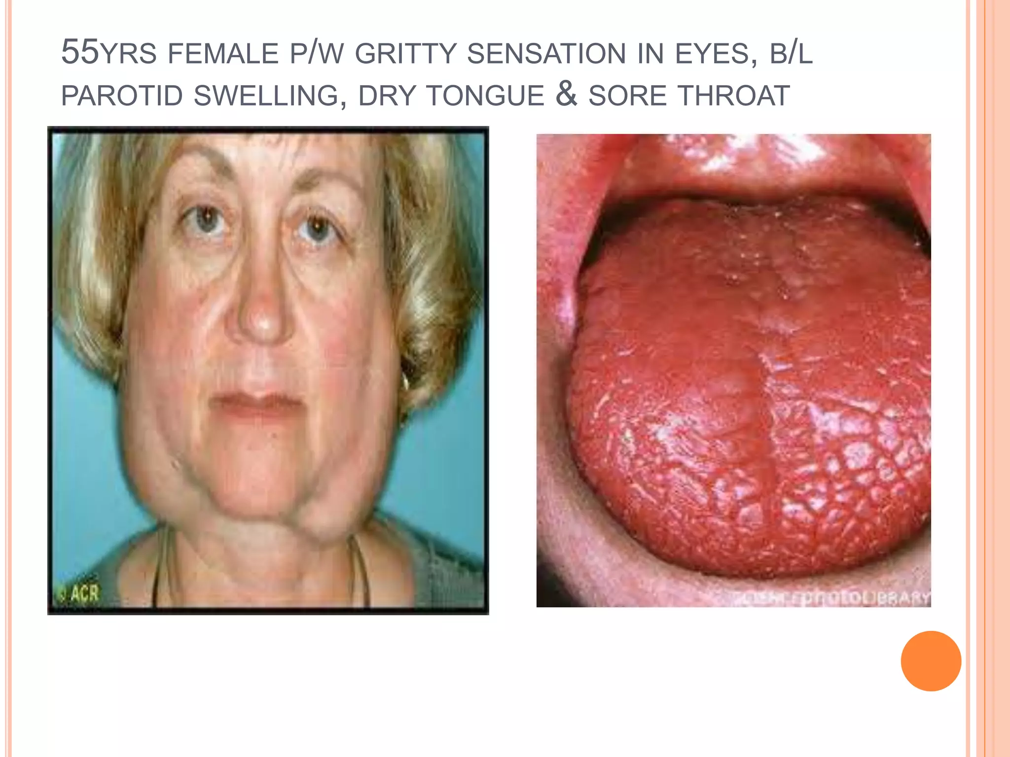 Is A Positive Ana Icd 10 Always A Serious Issue? - t14yjwg