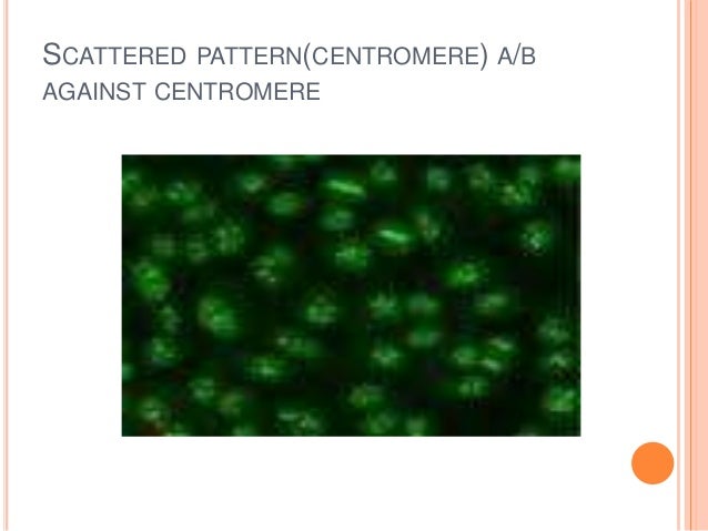 Approach To A Patient With Positive Ana Levels 40 Impressive Ana Nucleolar Pattern Approach To A Patient With Positive Ana Levels 40 Impressive Ana Nucleolar Pattern