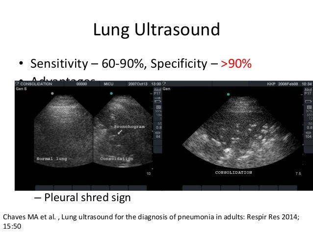 Approach to a patient with respiratory infection