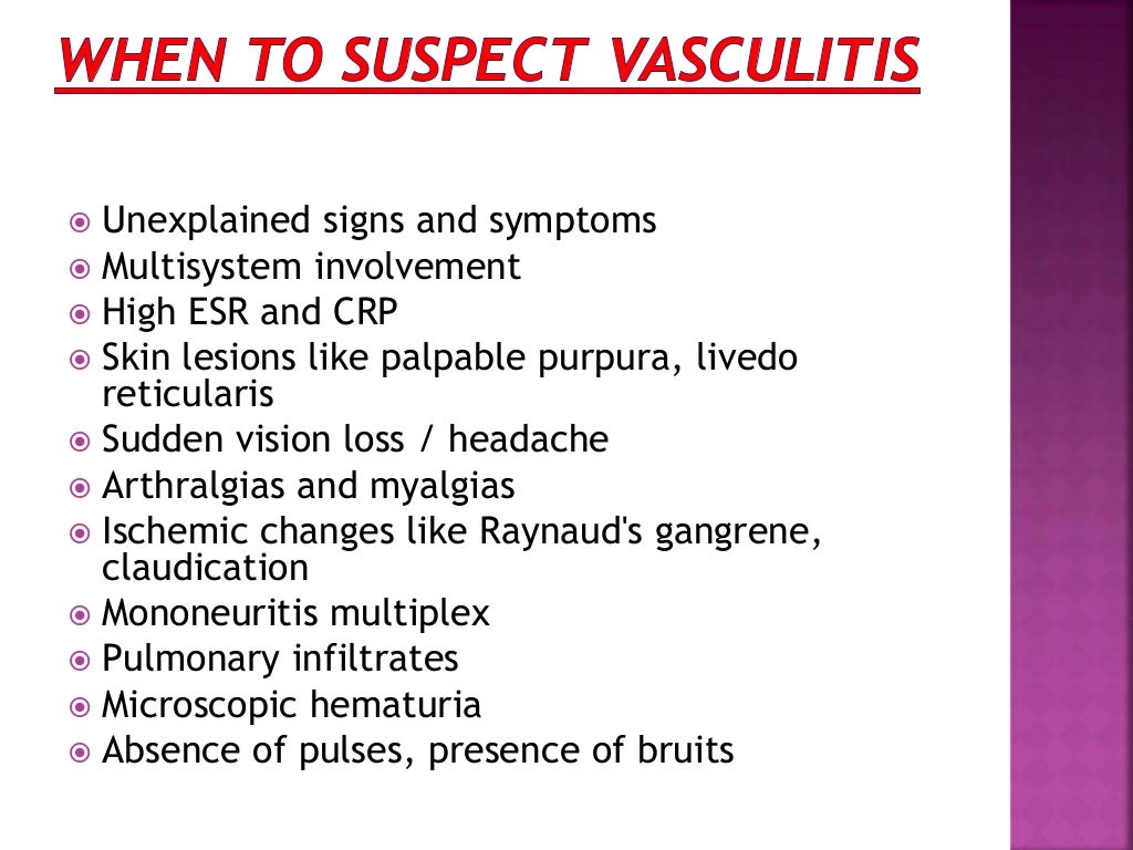 Approach to a patient with vasculitis and its