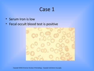 Approach to a pationt with pallor | PPT