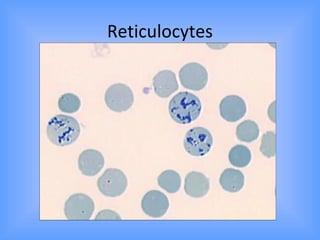 Approach to a pationt with pallor | PPT