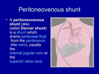 Peritoneovenous shunt
• A peritoneovenous
shunt (also
called Denver shunt)
is a shunt which
drains peritoneal fluid
from the peritoneum
into veins, usually
the
internal jugular vein or
the
superior vena cava

 