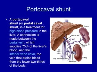 Portocaval shunt
• A portacaval
shunt (or portal caval
shunt) is a treatment for
high blood pressure in the
liver. A connection is
made between the
portal vein, which
supplies 75% of the liver's
blood, and the
inferior vena cava, the
vein that drains blood
from the lower two-thirds
of the body.

 