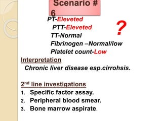PT-Eleveted
PTT-Eleveted
TT-Normal
Fibrinogen –Normal/low
Platelet count-Low
Interpretation
Chronic liver disease esp.cirrohsis.
2nd line investigations
1. Specific factor assay.
2. Peripheral blood smear.
3. Bone marrow aspirate.
Scenario #
6
?
 