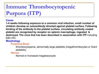 Immune Thrombocytopenic Purpura (ITP)   Cause 1-4 weeks following exposure to a common viral infection, small number of children develop an autoantibody directed against platelet surface. Following binding of the antibody to the platelet surface, circulating antibody coated platelet are recognized by receptor on splenic macrophage, ingested  & destroyed. The virus that has been described in association with ITP  including EBV,HIV. Morphology Peripheral Blood thrombocytopenia, abnormally large platelets (megathrombocytes or Giant platelets), Marrow Normal or Increased magakaryocyte  