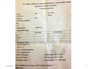 10/13/2018 11
SUNIL KUMAR P , ST.JOHN'S MEDICAL
COLLEGE
 