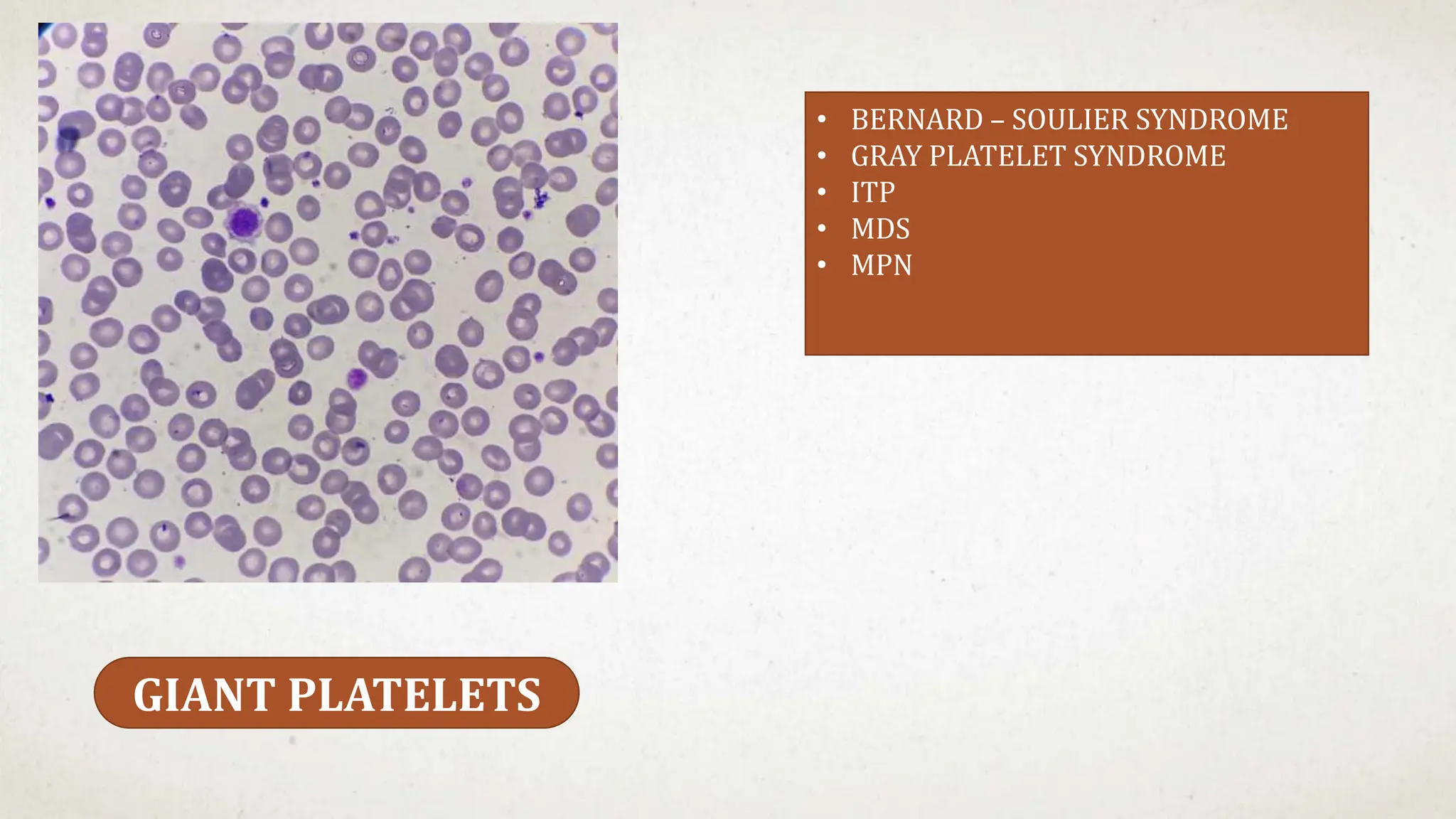 GIANT PLATELETS
• BERNARD – SOULIER SYNDROME
• GRAY PLATELET SYNDROME
• ITP
• MDS
• MPN
 