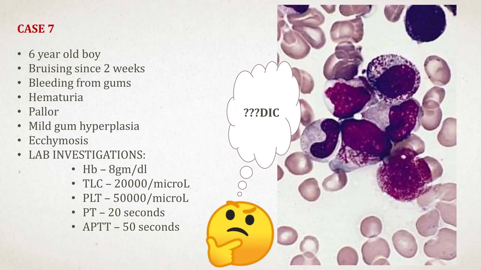 CASE 7
• 6 year old boy
• Bruising since 2 weeks
• Bleeding from gums
• Hematuria
• Pallor
• Mild gum hyperplasia
• Ecchymosis
• LAB INVESTIGATIONS:
• Hb – 8gm/dl
• TLC – 20000/microL
• PLT – 50000/microL
• PT – 20 seconds
• APTT – 50 seconds
???DIC
 