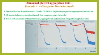 Abnormal platelet aggregation tests ~
Scenario 1. ~ Glanzman Thrombasthenia
1. In Glanzmann’s thrombasthenia, Platelet GPIIb/IIIa (important for platelet aggregation) is defective.
3. All agents induce aggregation through this receptor except ristocetin.
4. Hence in Glanzmann’s thrombasthenia, aggregation is defective for all agents except ristocetin.
 