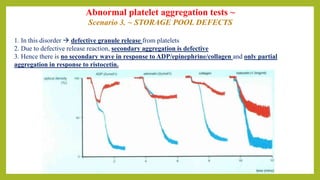 Abnormal platelet aggregation tests ~
Scenario 3. ~ STORAGE POOL DEFECTS
1. In this disorder  defective granule release from platelets
2. Due to defective release reaction, secondary aggregation is defective
3. Hence there is no secondary wave in response to ADP/epinephrine/collagen and only partial
aggregation in response to ristocetin.
 