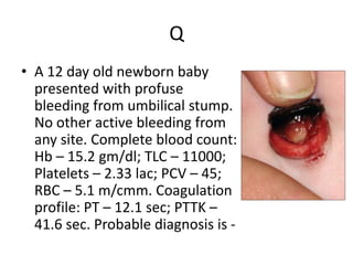 Approach to bleeding neonate | PPTX