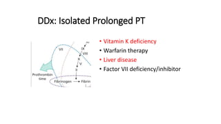 DDx: Isolated Prolonged PT
• Vitamin K deficiency
• Warfarin therapy
• Liver disease
• Factor VII deficiency/inhibitor
 