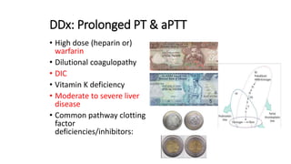 DDx: Prolonged PT & aPTT
• High dose (heparin or)
warfarin
• Dilutional coagulopathy
• DIC
• Vitamin K deficiency
• Moderate to severe liver
disease
• Common pathway clotting
factor
deficiencies/inhibitors:
 