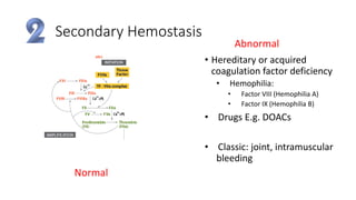 Secondary Hemostasis
Normal
Abnormal
• Hereditary or acquired
coagulation factor deficiency
• Hemophilia:
• Factor VIII (Hemophilia A)
• Factor IX (Hemophilia B)
• Drugs E.g. DOACs
• Classic: joint, intramuscular
bleeding
 